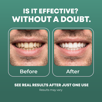 Peroxide-Free Whitening Strips (Checkout Deal)
