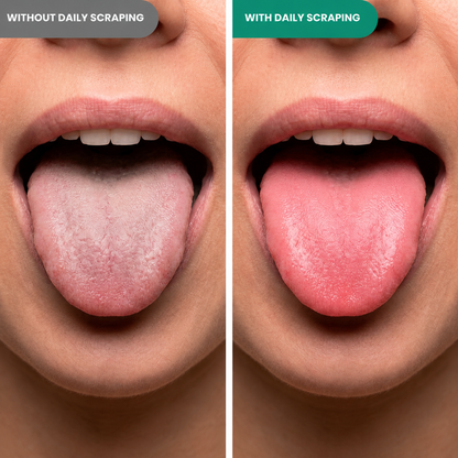 RVS Tongue Scraper